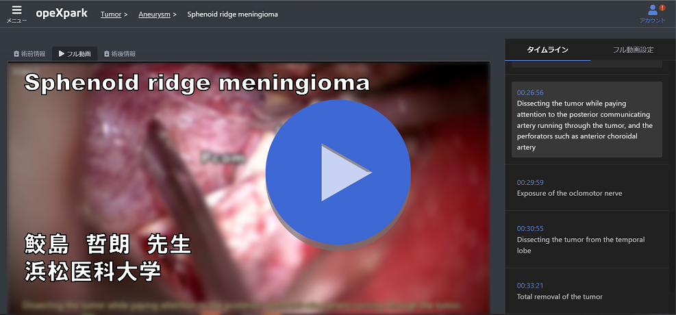 Sphenoid ridge meningioma  鮫島 哲朗　先生　浜松医科大学