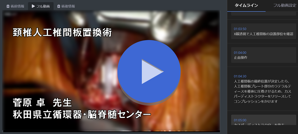 「頚椎人工椎間板置換術」菅原 卓-秋田県立循環器・脳脊髄センター