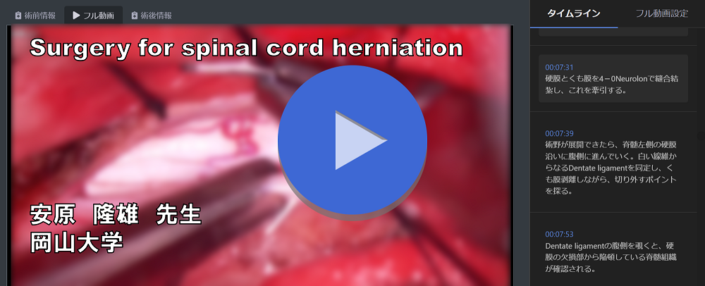 「Surgery for spinal cord herniation」 （岡山大学　安原 隆雄 先生）