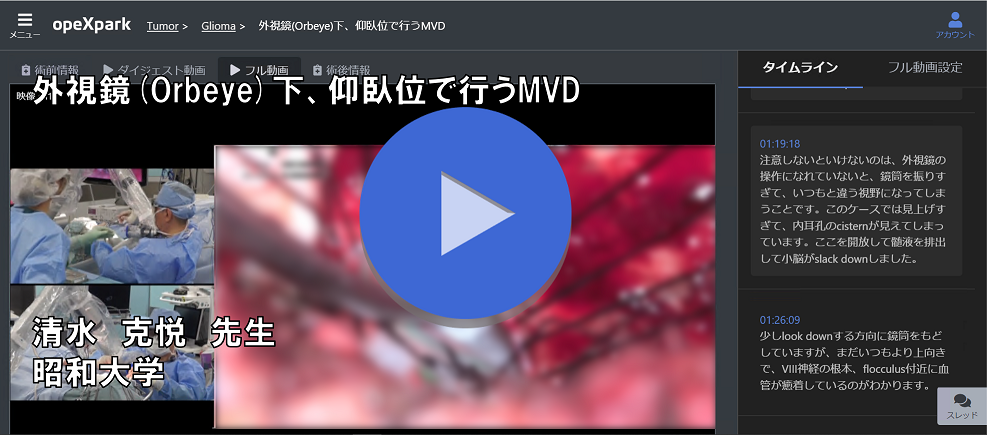 外視鏡(Orbeye)下、仰臥位で行うMVD