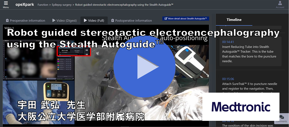 「Robot guided stereotactic electroencephalography using the Stealth Autoguide™」