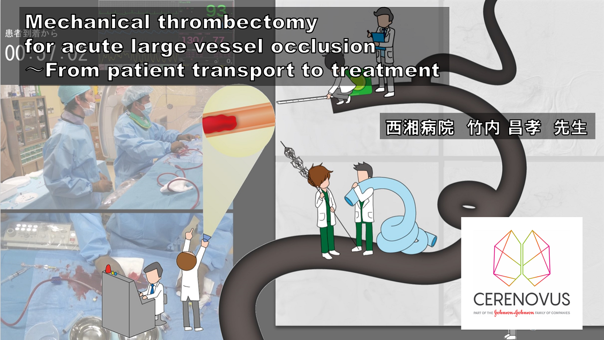 Mechanical thrombectomy for acute large vessel occlusion〜From patient transport to treatment｜症例動画