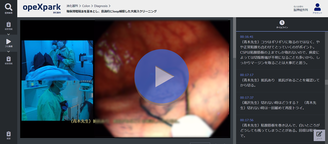 「軸保持短縮法を基本とし、意識的にloop解除した大腸スクリーニング」のサムネイル画像