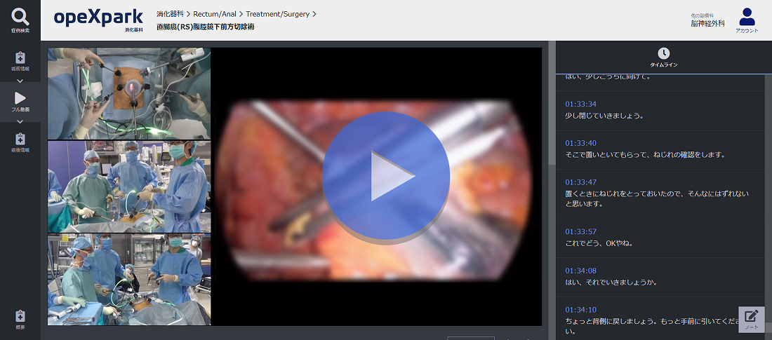 「直腸癌(RS)腹腔鏡下前方切除術」のサムネイル画像
