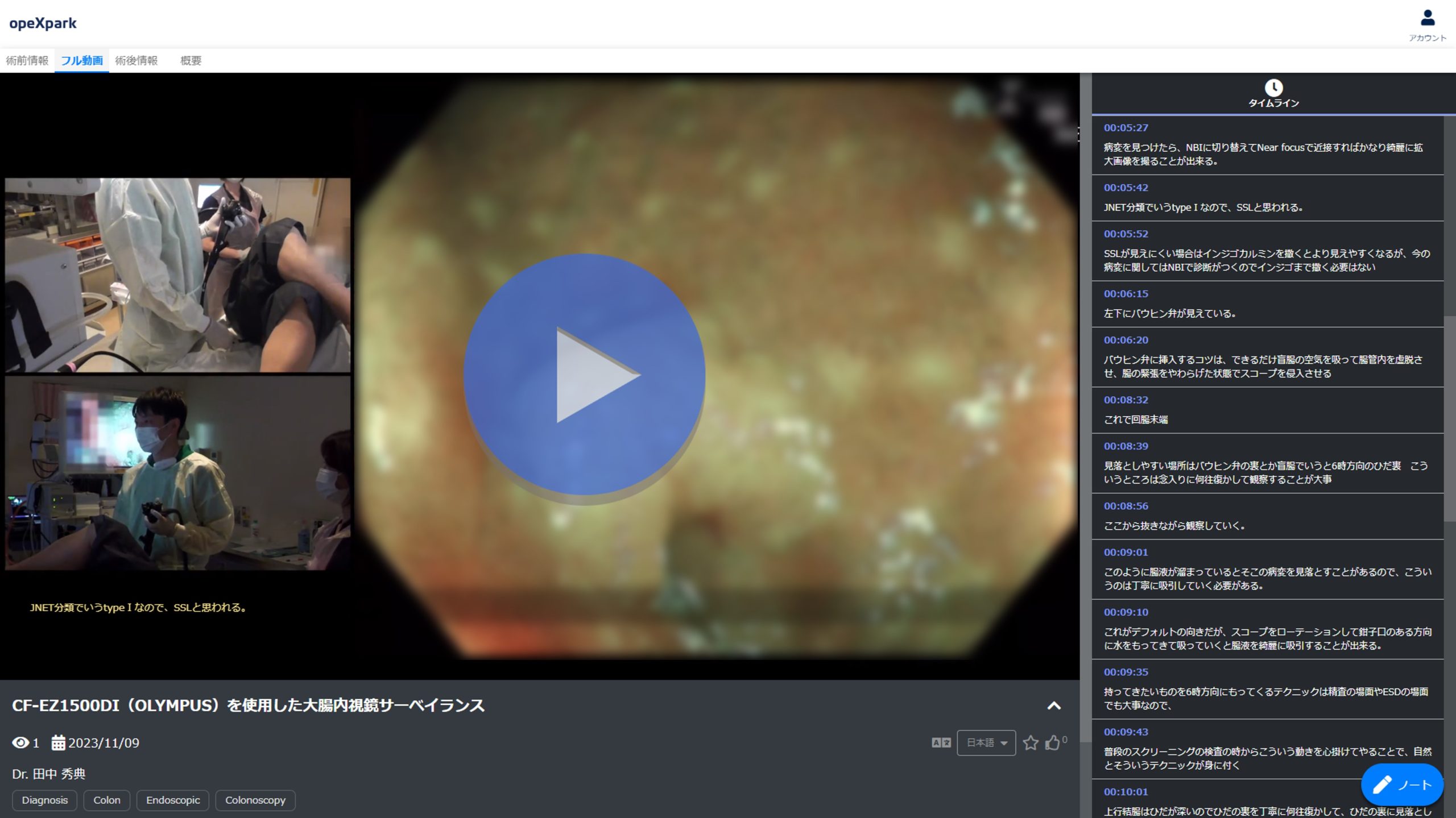 「CF-EZ1500DI（OLYMPUS）を使用した大腸内視鏡サーベイランス」のサムネイル画像