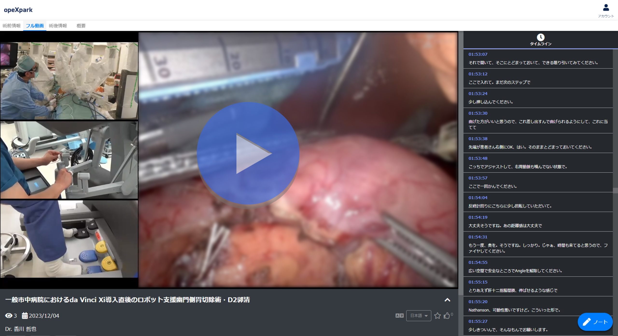 「一般市中病院におけるda Vinci Xi導入直後のロボット支援幽門側胃切除術・D2郭清」のサムネイル画像