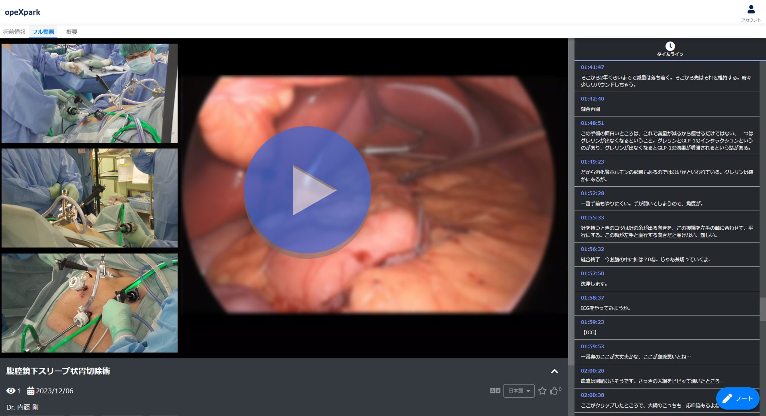 「腹腔鏡下スリーブ状胃切除術」のサムネイル画像