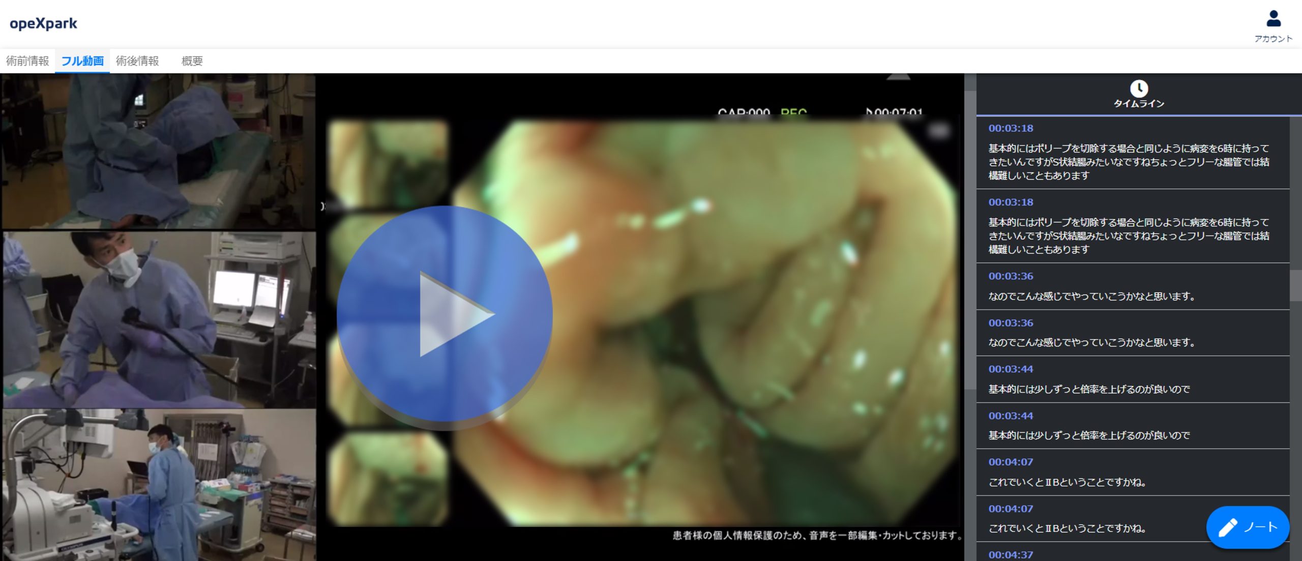 「T1大腸がんの内視鏡診断」のサムネイル画像