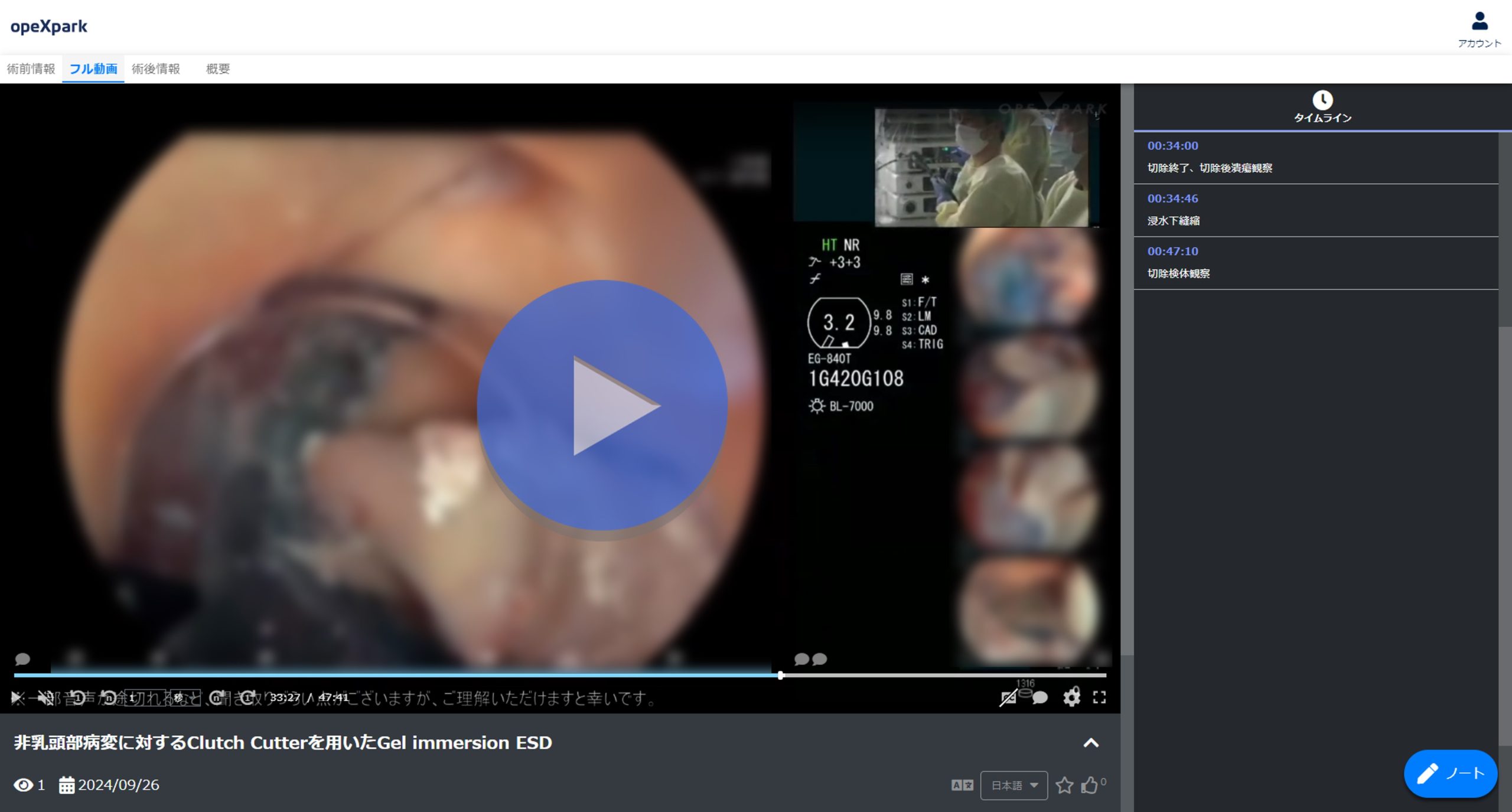 「非乳頭部病変に対するClutch Cutterを用いたGel immersion ESD」のサムネイル画像