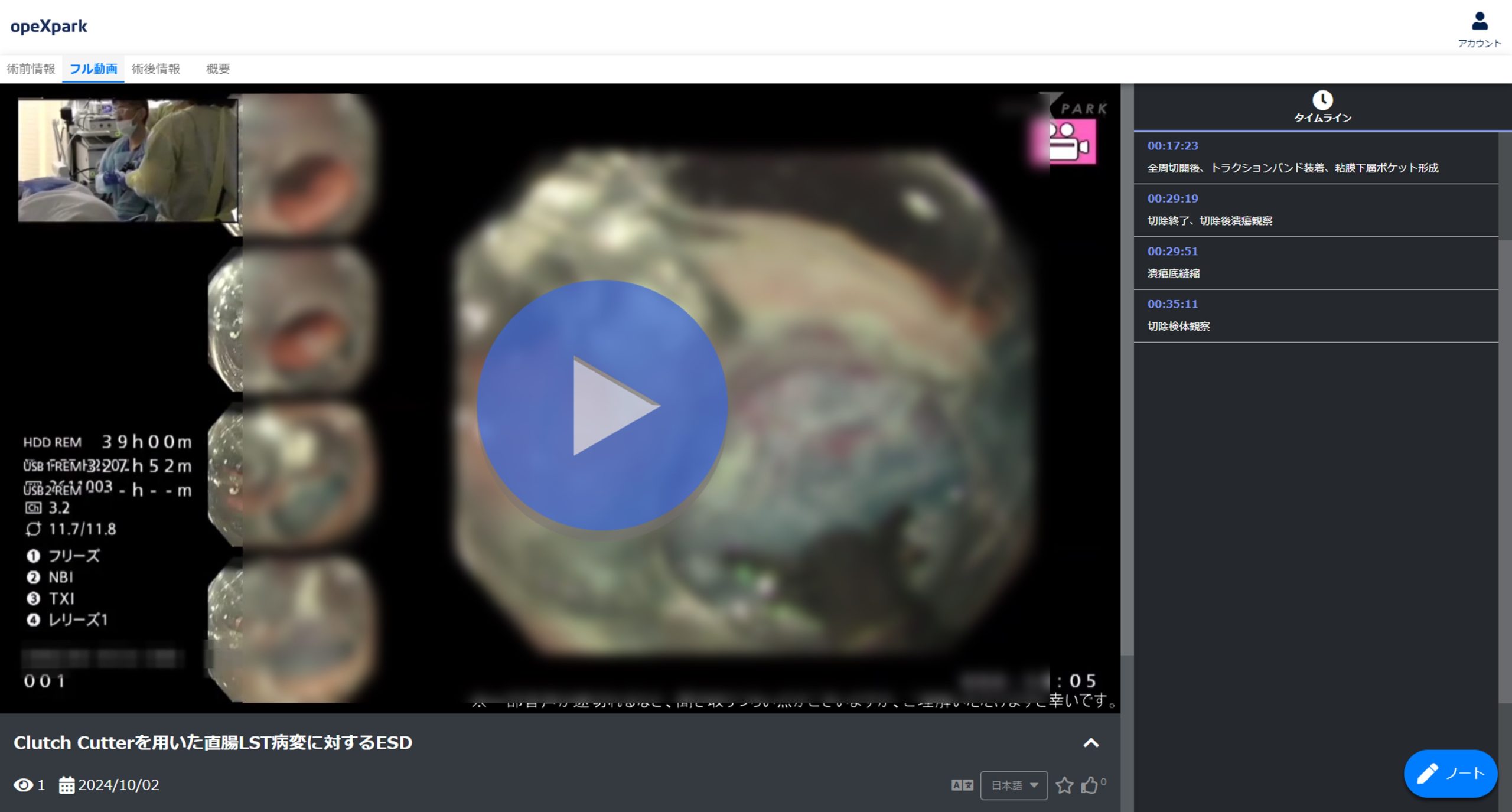 「Clutch Cutterを用いた直腸LST病変に対するESD」のサムネイル画像