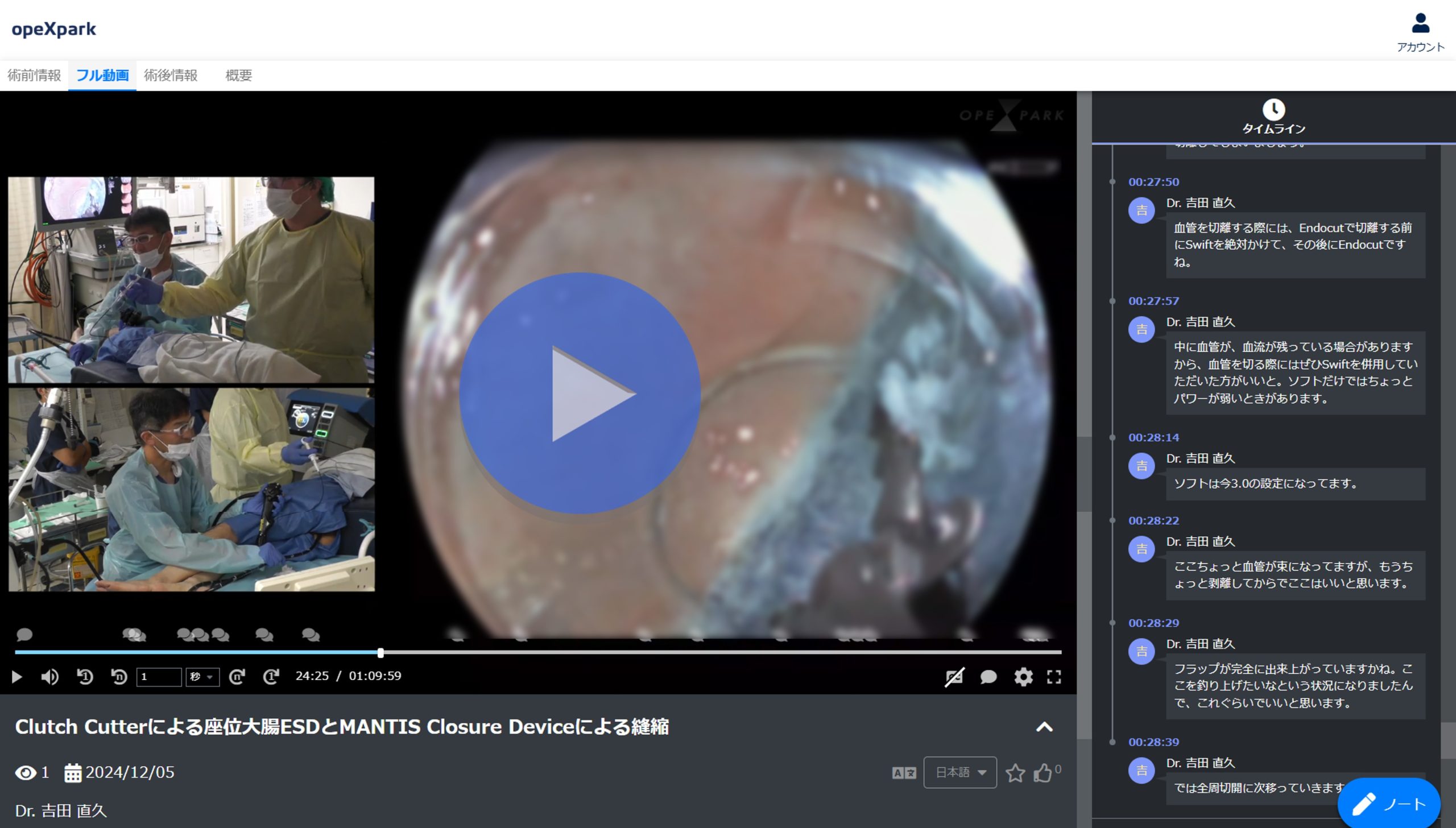 「Clutch Cutterによる座位大腸ESDとMANTIS Closure Deviceによる縫縮」のサムネイル画像