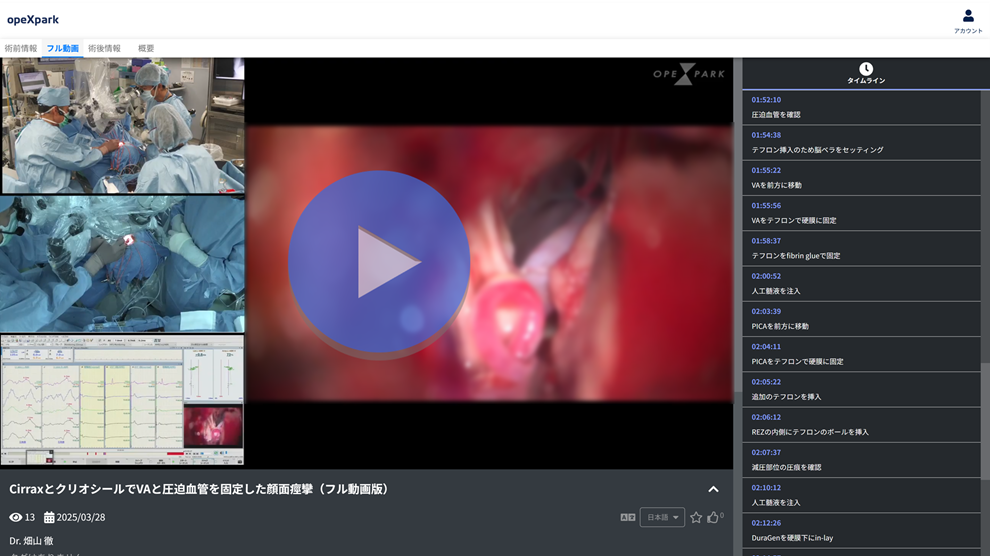 「CirraxとクリオシールでVAと圧迫血管を固定した顔面痙攣」のサムネイル画像