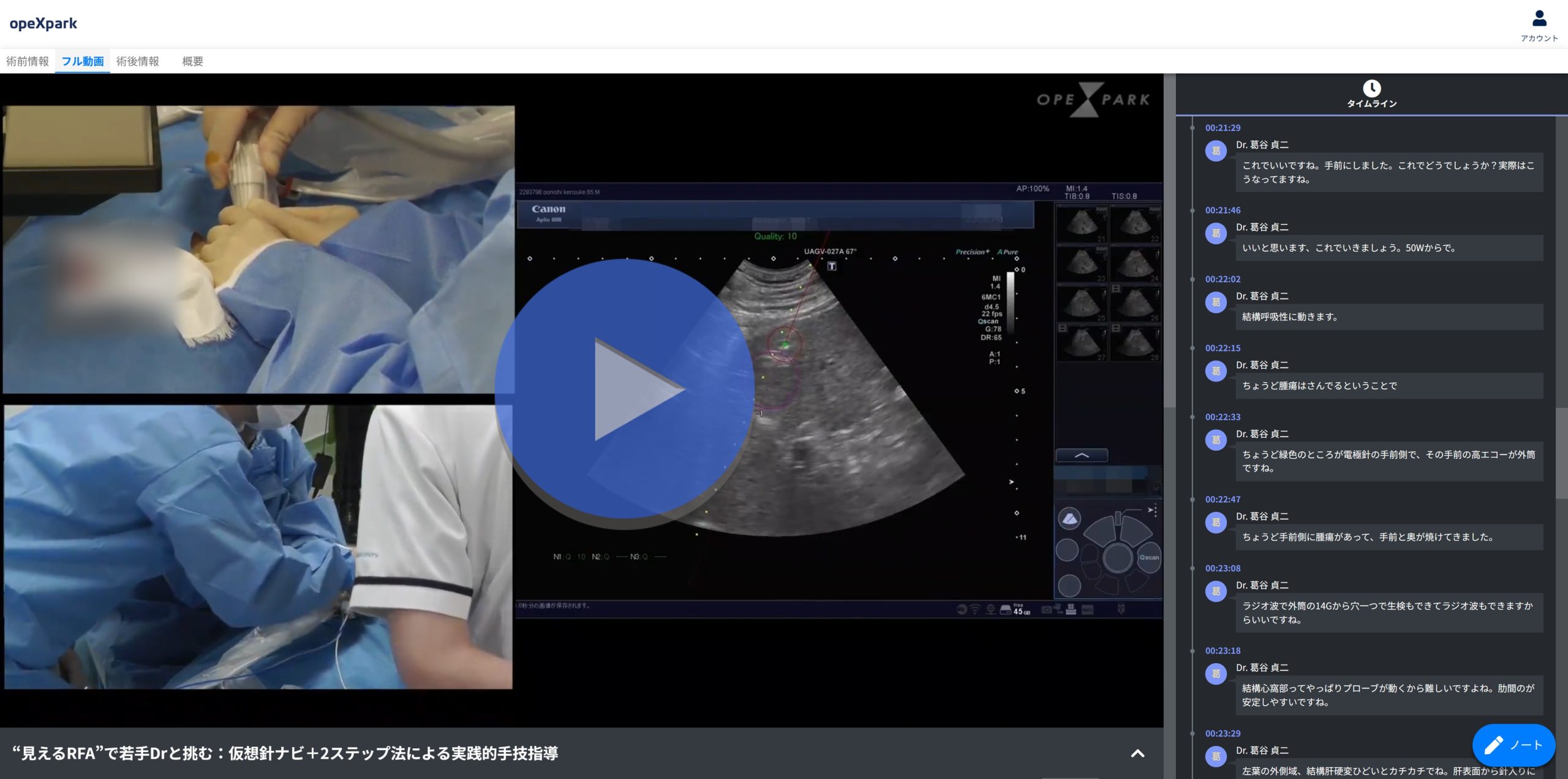 「“見えるRFA”で若手Drと挑む：仮想針ナビ＋2ステップ法による実践的手技指導」のサムネイル画像