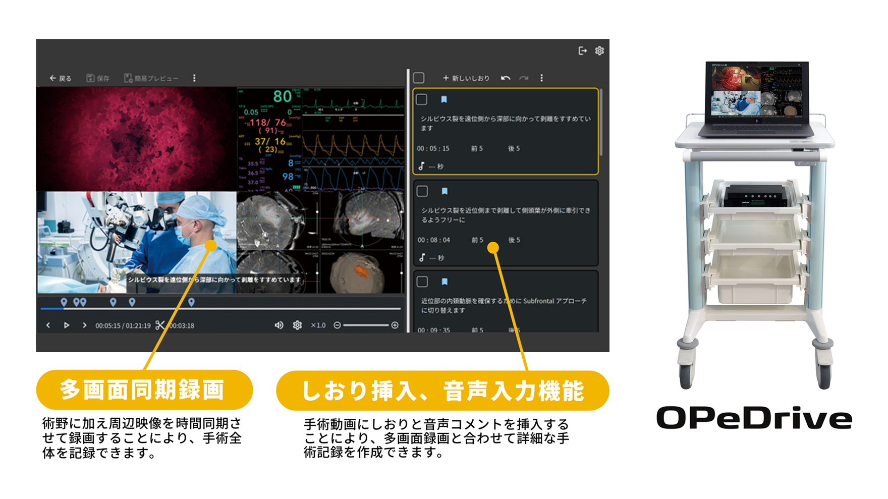 OPeDrive主な機能