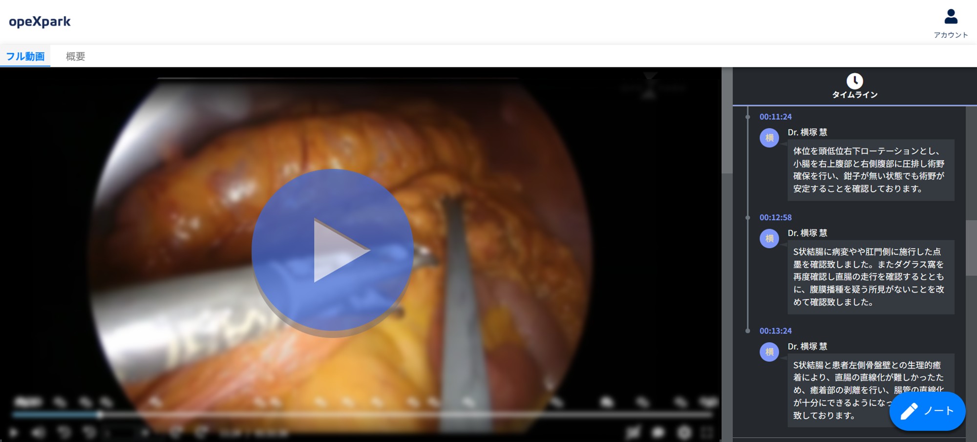 「S状結腸切除術 技術認定合格症例｜受験者が押さえるべき要点をノーカットで解説」のサムネイル画像
